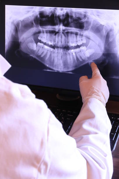 Best Emergency Wisdom Teeth Removal in Harrisonville, MO