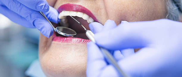Best Emergency Tooth Extraction in Harrisonville, MO